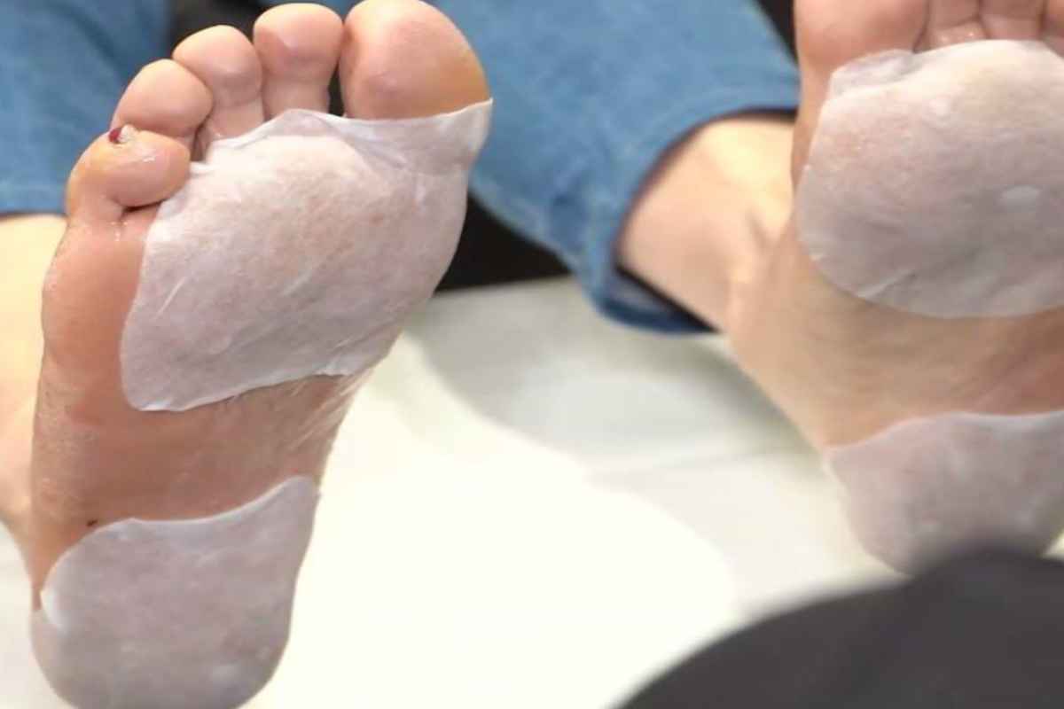 pelle secca dei piedi e soluzioni
